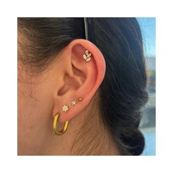 Arete Mossi